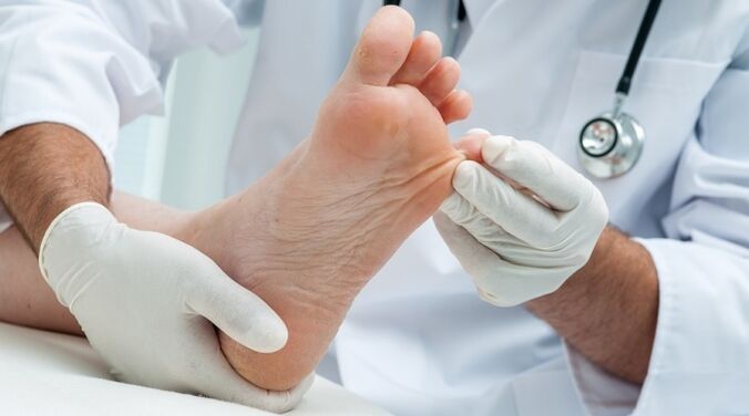 Badanie płytki paznokcia przez dermatologa w celu rozpoznania grzybicy paznokci
