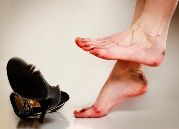 Rozwój grzyba paznokci może być spowodowany ciasnymi butami